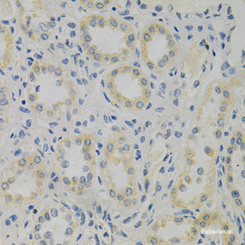 Immunohistochemistry of paraffin-embedded Rat liver using PRKAG2 Polyclonal Antibody at dilution of 1:100 (40x lens).