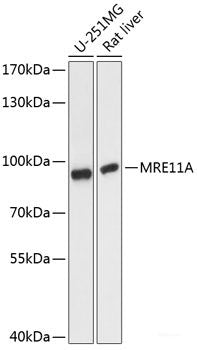 Western blot analysis of extracts of Rat liver using ZSCAN31 Polyclonal Antibody at dilution of 1:3000.