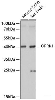 Western blot analysis of extracts of various cell lines using RXFP2 Polyclonal Antibody at dilution of 1:3000.