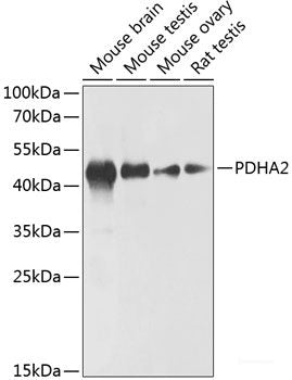 Western blot analysis of extracts of Rat liver using ADH1B Polyclonal Antibody at dilution of 1:1000.