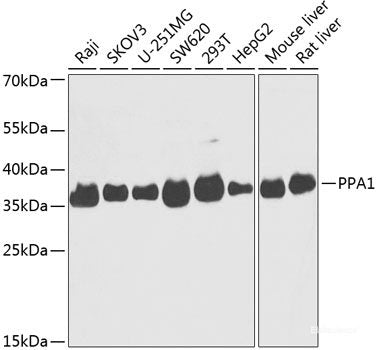 Immunohistochemistry of paraffin-embedded Rat brain using ZNF703 Polyclonal Antibody at dilution of 1:100 (40x lens).