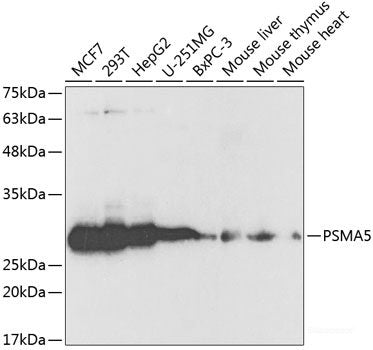 Western blot analysis of extracts of various cell lines using LHPP Polyclonal Antibody at dilution of 1:1000.