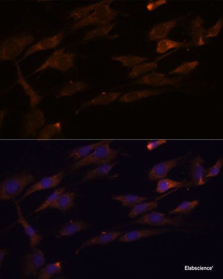 Immunofluorescence analysis of NIH/3T3 cells using SLC25A23 Polyclonal Antibody at dilution of 1:100. Blue: DAPI for nuclear staining.