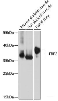 Immunohistochemistry of paraffin-embedded Rat pancreas using NME6 Polyclonal Antibody at dilution of 1:100 (40x lens).