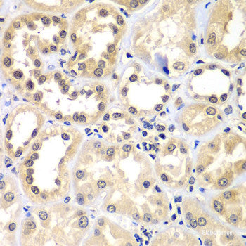 Immunofluorescence analysis of HeLa cells using INMT Polyclonal Antibody at dilution of 1:100. Blue: DAPI for nuclear staining.
