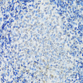 Immunohistochemistry of paraffin-embedded Rat liver using CCDC59 Polyclonal Antibody at dilution of 1:100 (40x lens).