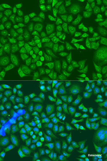Western blot analysis of extracts of various cell lines using p38 MAPK Polyclonal Antibody at dilution of 1:1000.