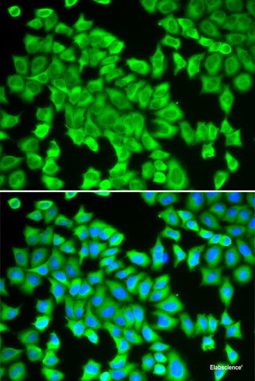 Immunofluorescence analysis of NIH-3T3 cells using TXNDC12 Polyclonal Antibody at dilution of 1:100 (40x lens). Blue: DAPI for nuclear staining.