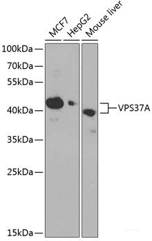 Immunohistochemistry of paraffin-embedded Human colon using CA13 Polyclonal Antibody at dilution of 1:100 (40x lens).