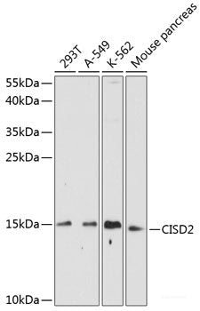 Immunohistochemistry of paraffin-embedded Rat heart using MZB1 Polyclonal Antibody at dilution of 1:100 (40x lens).