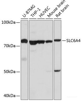Immunohistochemistry of paraffin-embedded Human lung using BRIX1 Polyclonal Antibody at dilution of 1:100 (40x lens).
