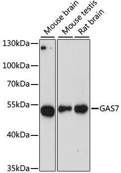 Western blot analysis of extracts of Rat lung using ETS2 Polyclonal Antibody at dilution of 1:3000.