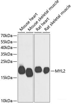 Western blot analysis of extracts of various cell lines using DYNLL1 Polyclonal Antibody at dilution of 1:500.