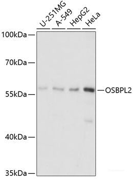 Western blot analysis of extracts of various cell lines using ZAK Polyclonal Antibody at dilution of 1:3000.