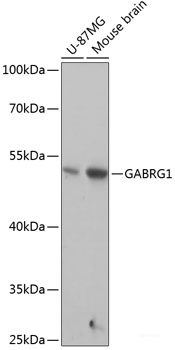 Western blot analysis of extracts of K-562 cells using HBA1 Polyclonal Antibody at dilution of 1:3000.