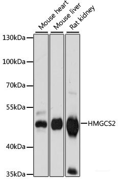 Western blot analysis of extracts of various cell lines using CHRM3 Polyclonal Antibody at dilution of 1:3000.