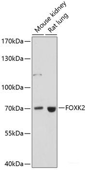 Western blot analysis of extracts of Mouse brain using EFNB1 Polyclonal Antibody at dilution of 1:1000.
