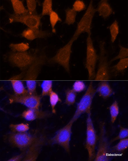 Western blot analysis of extracts of various cell lines using ABI3BP Polyclonal Antibody at dilution of 1:1000.