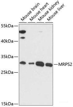 Western blot analysis of extracts of various cell lines using LZTS2 Polyclonal Antibody at dilution of 1:1000.