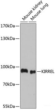 Immunohistochemistry of paraffin-embedded Rat testis using SLC2A9 Polyclonal Antibody at dilution of 1:100 (40x lens).