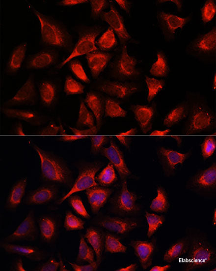Immunofluorescence analysis of HeLa cells using DCX Polyclonal Antibody at dilution of 1:100. Blue: DAPI for nuclear staining.
