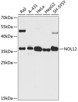Immunohistochemistry of paraffin-embedded Rat kidney using RPS27A Polyclonal Antibody at dilution of 1:100 (40x lens).