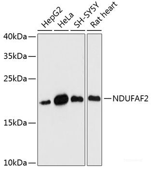Immunofluorescence analysis of Rat eye using MYH13 Polyclonal Antibody at dilution of 1:100 (40x lens). Blue: DAPI for nuclear staining.