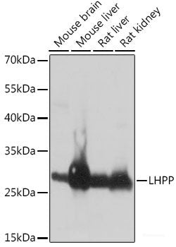 Western blot analysis of extracts of various cell lines using TLR9 Polyclonal Antibody at dilution of 1:1000.