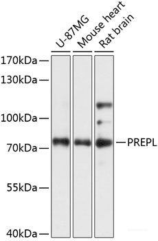 Immunohistochemistry of paraffin-embedded Rat liver using HMGN1 Polyclonal Antibody at dilution of 1:100 (40x lens).