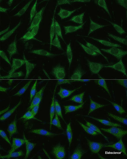 Immunohistochemistry of paraffin-embedded Rat spleen using IL4R Polyclonal Antibody at dilution of 1:100 (40x lens).