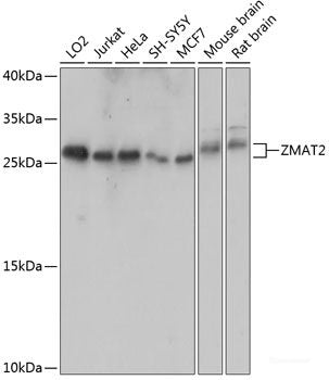 Immunohistochemistry of paraffin-embedded Human uterus using XBP1 Polyclonal Antibody at dilution of 1:100 (40x lens).
