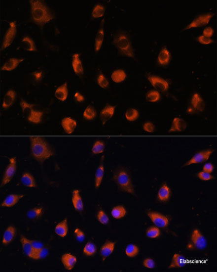 Immunohistochemistry of paraffin-embedded Mouse kidney using PDGFD Polyclonal Antibody at dilution of 1:100 (40x lens).