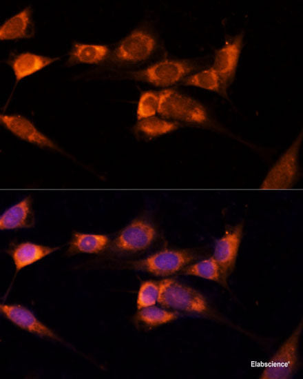 Immunofluorescence analysis of C6 cells using ABCB11 Polyclonal Antibody at dilution of 1:100. Blue: DAPI for nuclear staining.