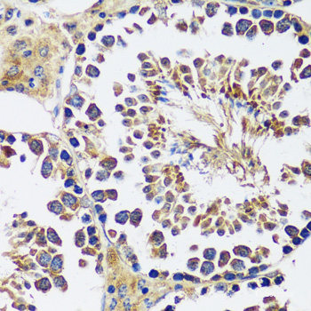 Immunofluorescence analysis of THP-1 cells using CD36 Polyclonal Antibody at dilution of 1:100. Blue: DAPI for nuclear staining.