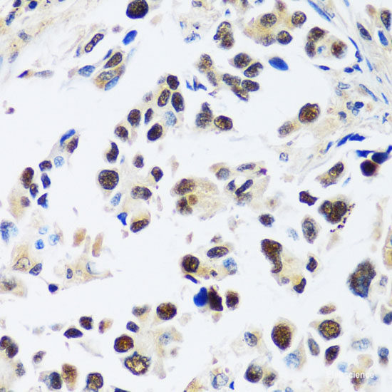 Immunofluorescence analysis of HeLa cells using CDK11B Polyclonal Antibody at dilution of 1:100. Blue: DAPI for nuclear staining.