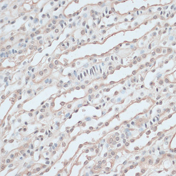 Immunofluorescence analysis of C6 cells using GBX2 Polyclonal Antibody at dilution of 1:100. Blue: DAPI for nuclear staining.