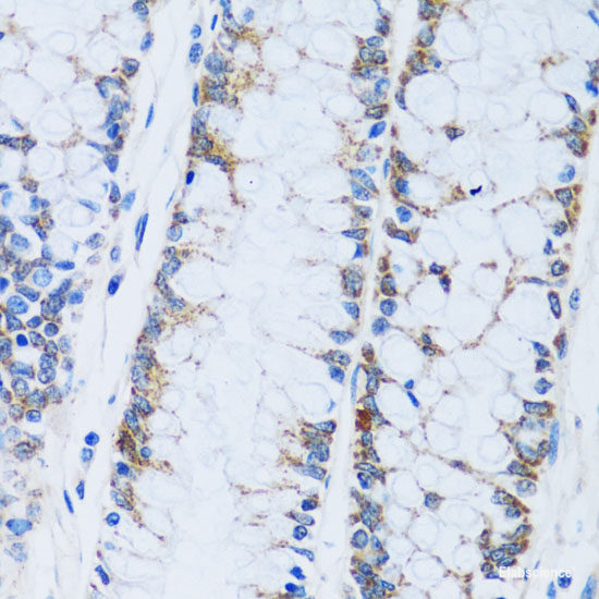 Western blot analysis of extracts of Mouse lung using BCAM Polyclonal Antibody at dilution of 1:1000.