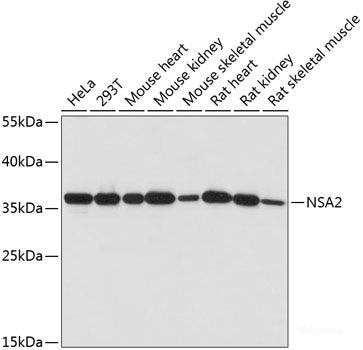Western blot analysis of extracts from normal (control) and NDUFA5 knockout (KO) HeLa cells using NDUFA5 Polyclonal Antibody at dilution of 1:1000.