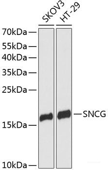 Immunofluorescence analysis of L929 cells using PDE6D Polyclonal Antibody at dilution of 1:100 (40x lens). Blue: DAPI for nuclear staining.
