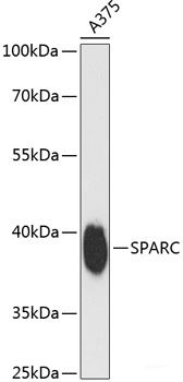 Immunohistochemistry of paraffin-embedded Human gastric cancer using ENPP3 Polyclonal Antibody at dilution of 1:150 (40x lens).