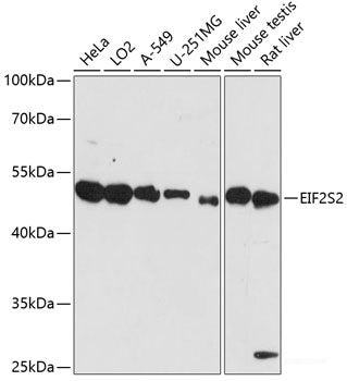Immunofluorescence analysis of C6 cells using PSMB7 Polyclonal Antibody at dilution of 1:100 (40x lens). Blue: DAPI for nuclear staining.