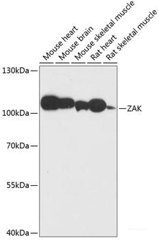 Immunohistochemistry of paraffin-embedded Human lung using RB1 Polyclonal Antibody at dilution of 1:100 (40x lens).