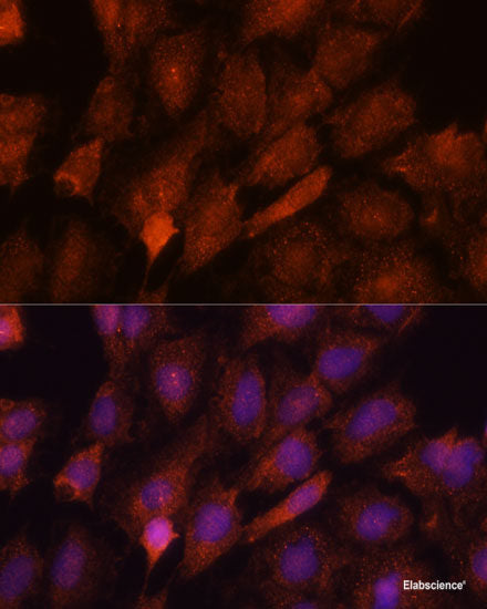 Western blot analysis of extracts of various cell lines using RDX Polyclonal Antibody at dilution of 1:1000.