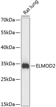 Immunohistochemistry of paraffin-embedded Rat brain using SLC22A5 Polyclonal Antibody at dilution of 1:100 (40x lens).