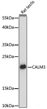 Western blot analysis of extracts of Rat spleen using TAL2 Polyclonal Antibody at dilution of 1:1000.