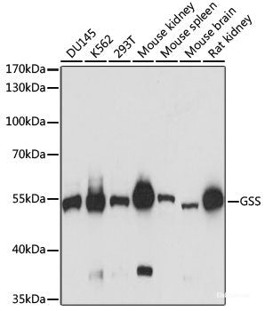 Immunohistochemistry of paraffin-embedded Rat pancreas using ZNF177 Polyclonal Antibody at dilution of 1:100 (40x lens).