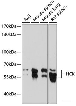 Immunofluorescence analysis of Jurkat cells using KLRC4 Polyclonal Antibody at dilution of 1:100 (40x lens). Blue: DAPI for nuclear staining.