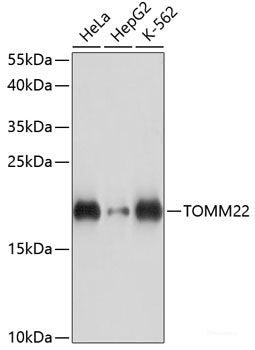 Immunohistochemistry of paraffin-embedded Human liver using SLC16A4 Polyclonal Antibody at dilution of 1:100 (40x lens).