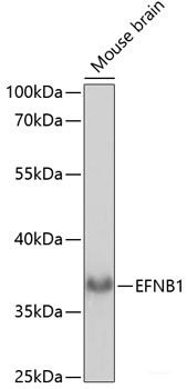 Immunohistochemistry of paraffin-embedded Rat heart using TLK1 Polyclonal Antibody at dilution of 1:100 (40x lens).