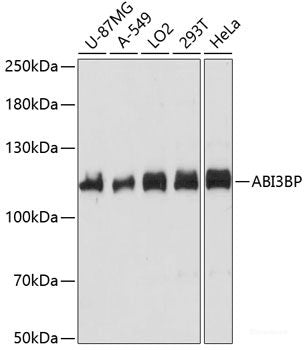 Immunofluorescence analysis of L929 cells using SWAP70 Polyclonal Antibody at dilution of 1:100. Blue: DAPI for nuclear staining.